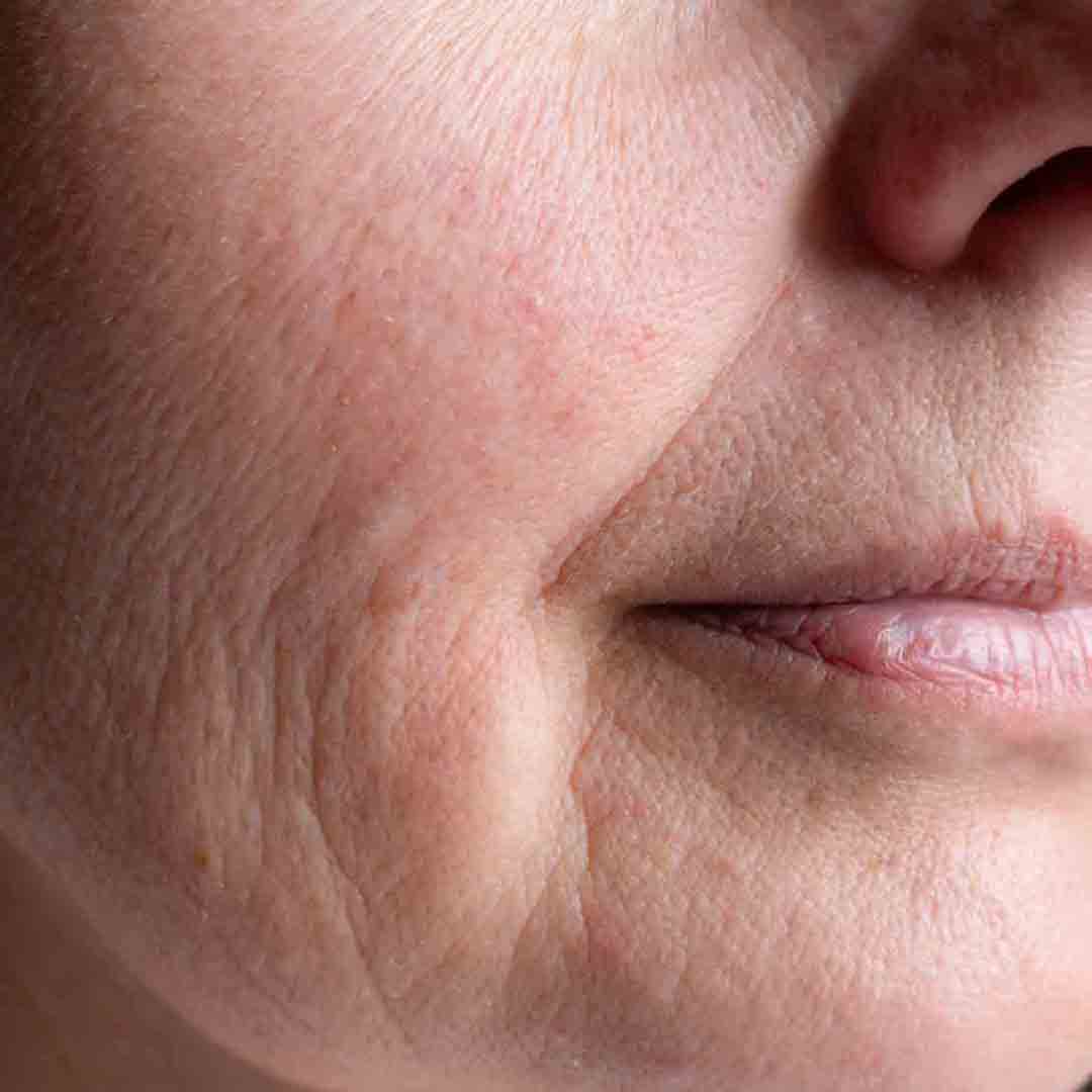 Face Sculpting+Wrinkle Defense Duo